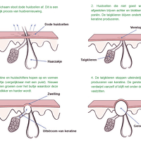 Gerstekorrels