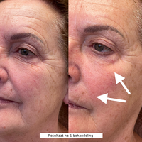 Oxygeneo Plus+