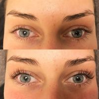 Wimperlifting
